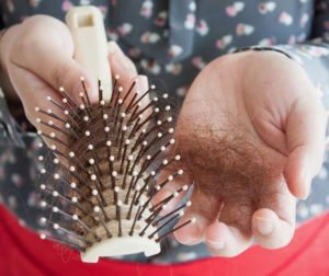 HAIR LOSS EXPERTS IN HALIFAX AT ANTHONY JAMES SALON