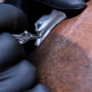 Scalp Micropigmentation